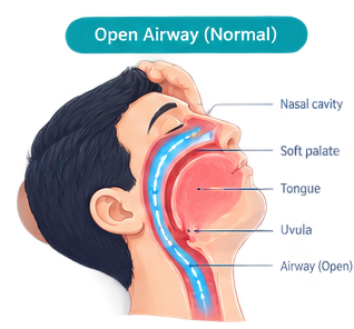 Open airway during normal sleep