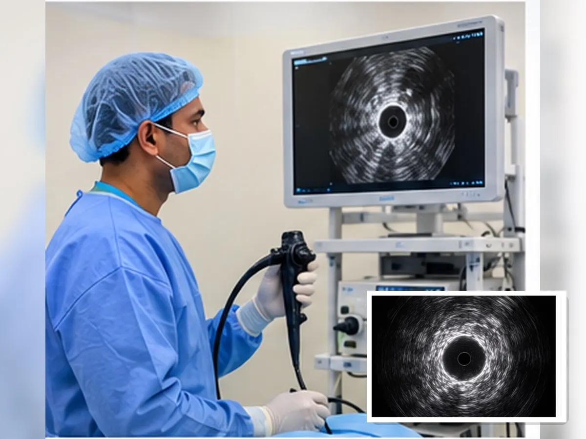 Radial EBUS probe used to biopsy a peripheral lung nodule